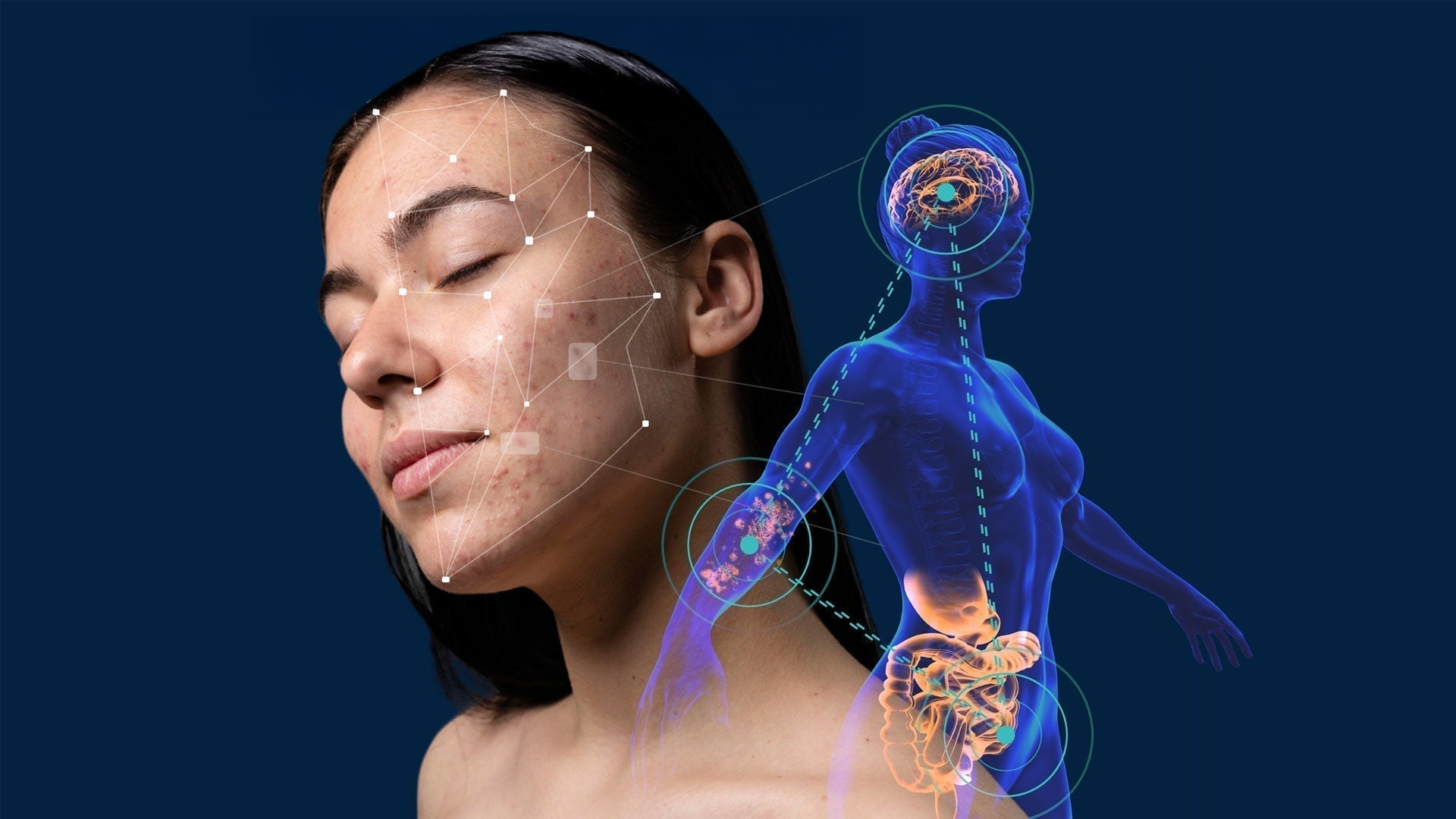 The Role of Gut Health Tests in Eczema Treatment