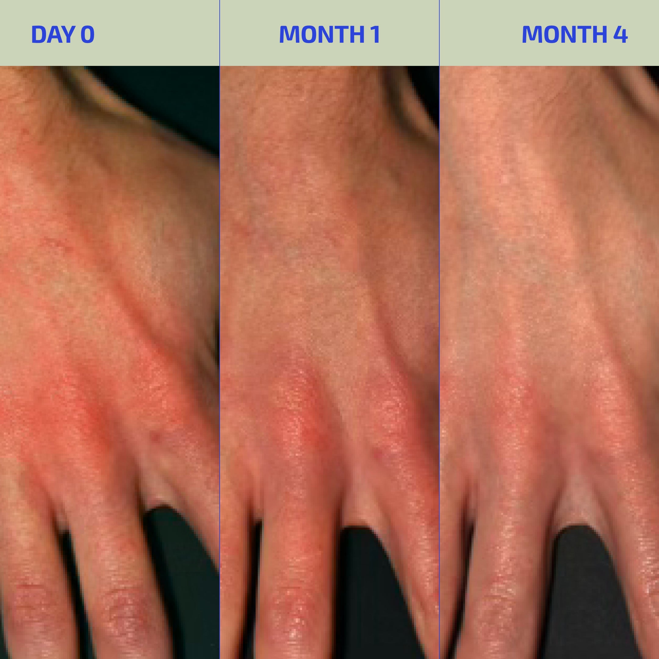 Eczema Relief Lotion + Soap Bundle (3m+)