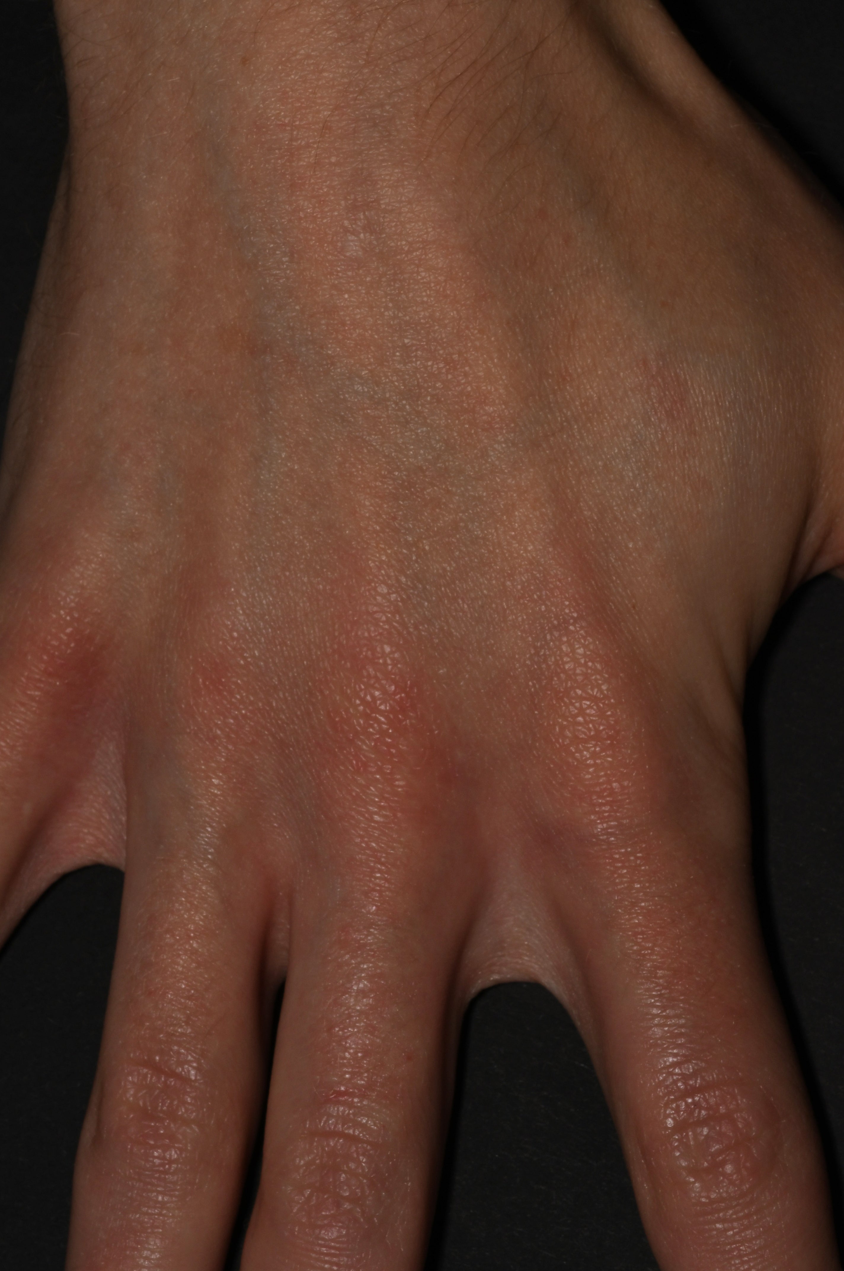 After treatment