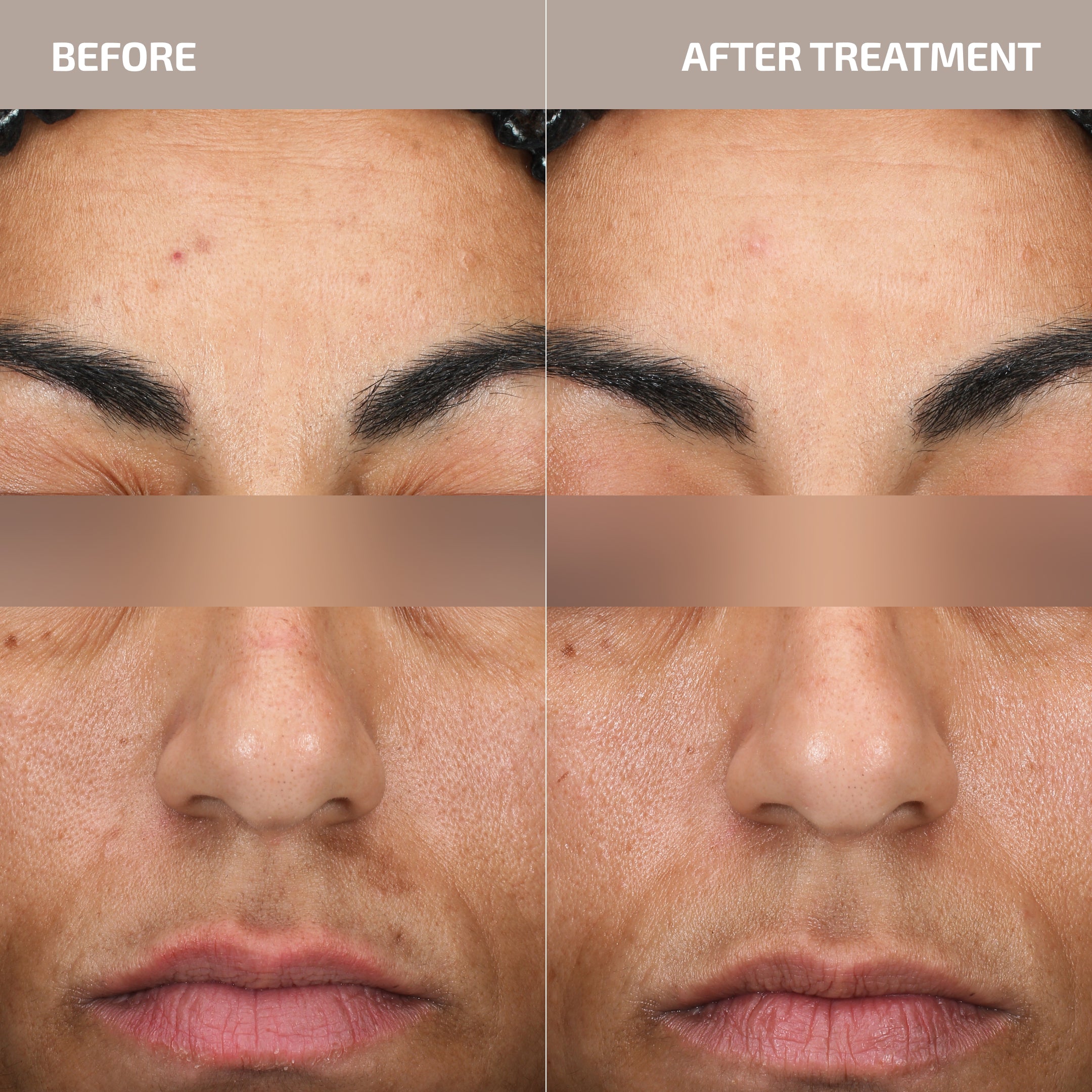 Skin Barrier Restoration Protocol (30+)