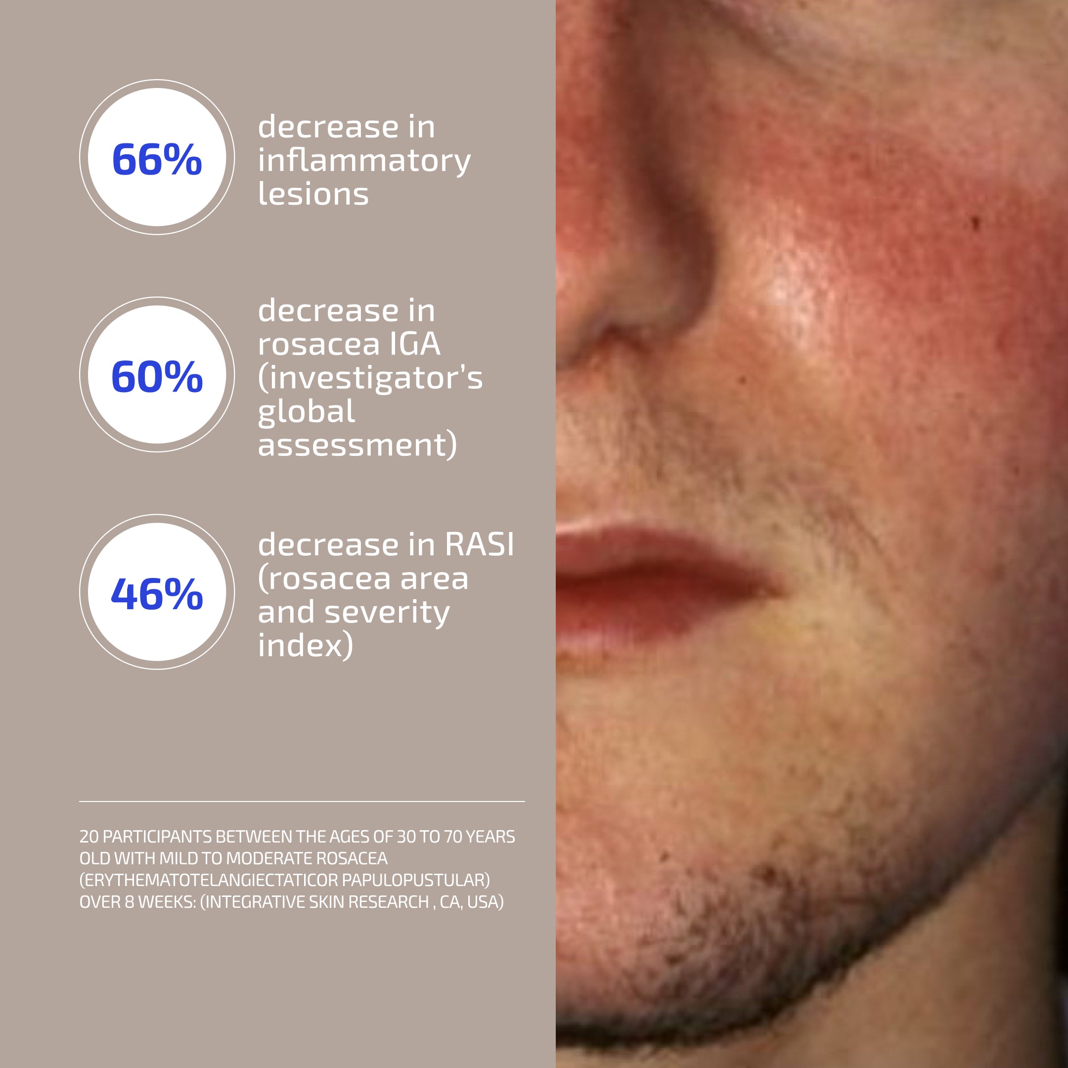 Antu Complexion Protocol - Skin Barrier L-histidine supplement & M3 Antioxidant Serum (Age: 30-60+)