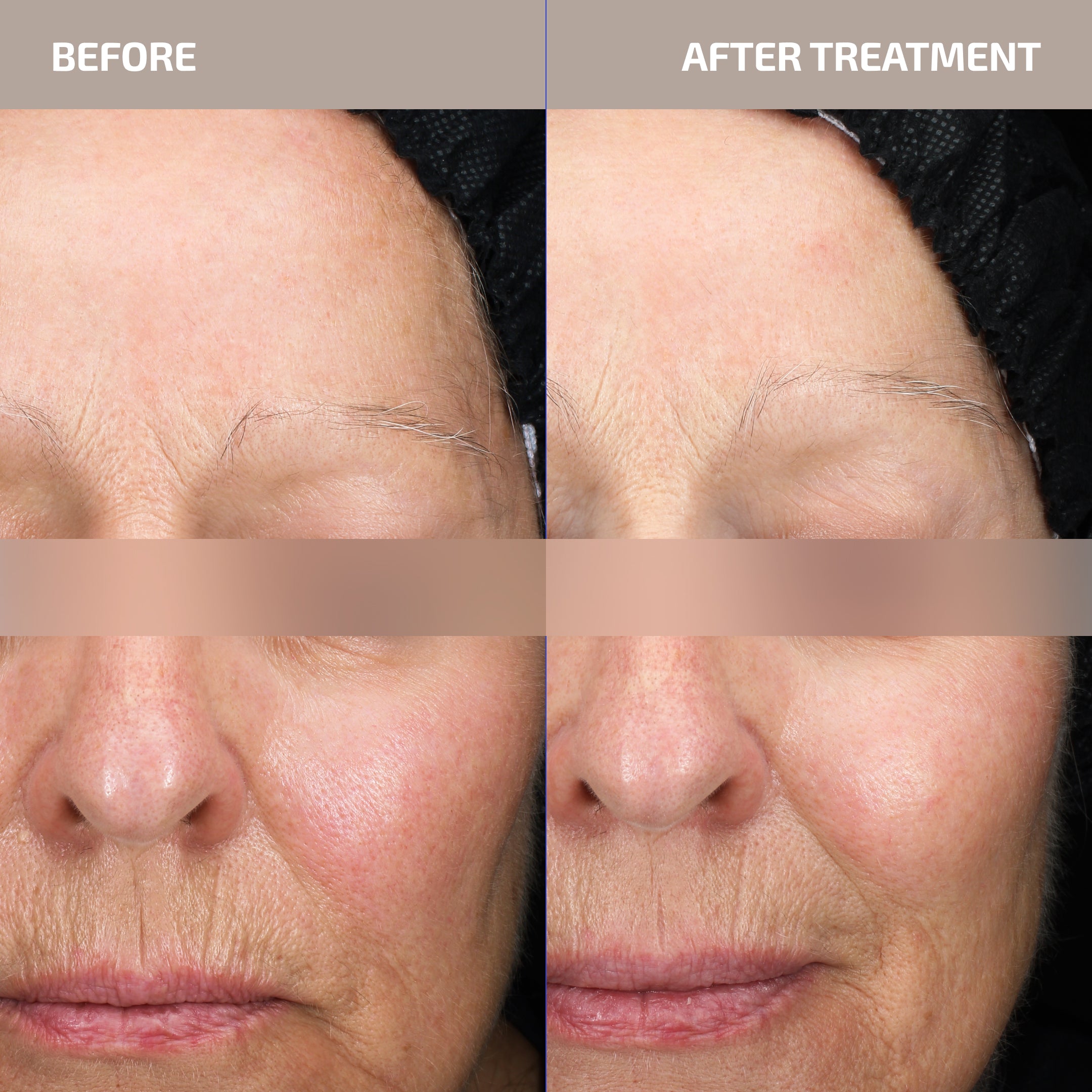 Skin Barrier Repair Serum – Combat Inflammaging & Redensify Mature Skin | ANTÜ (Age: 30-60+)