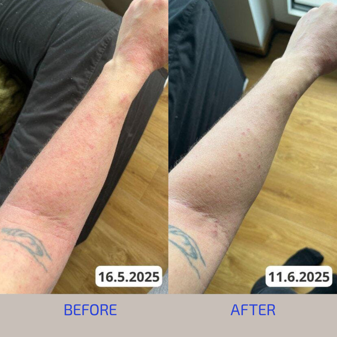 Before and after comparison of a person's arm with visible changes over time.