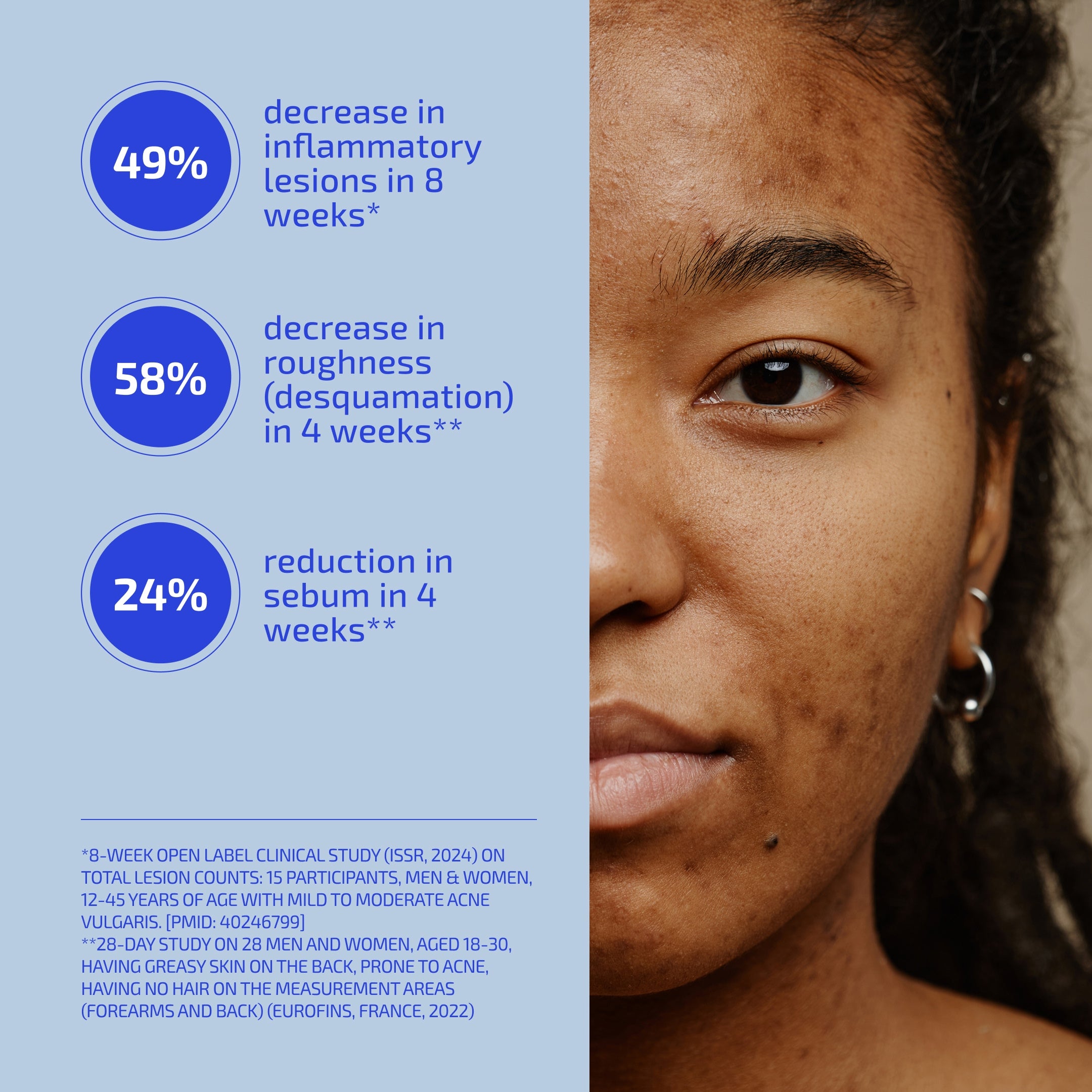 Body Acne (Bacne) Protocol - Body Scrub, Spot Treatment & Probiotic (Age: 18-60+)