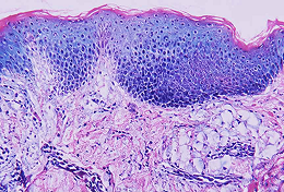 Outer Layer: Epidermis