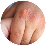 CALM ITCH & IRRITATION