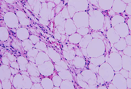 Deepest Layer: Hypodermis