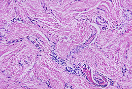 Middle Layer: Dermis