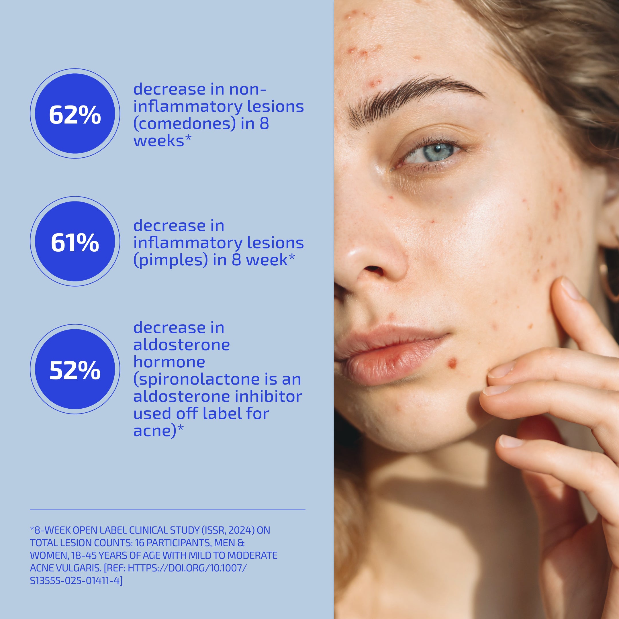 Acne & Stress Support Supplement Bundle – Probiotic + Skin De-Stress System