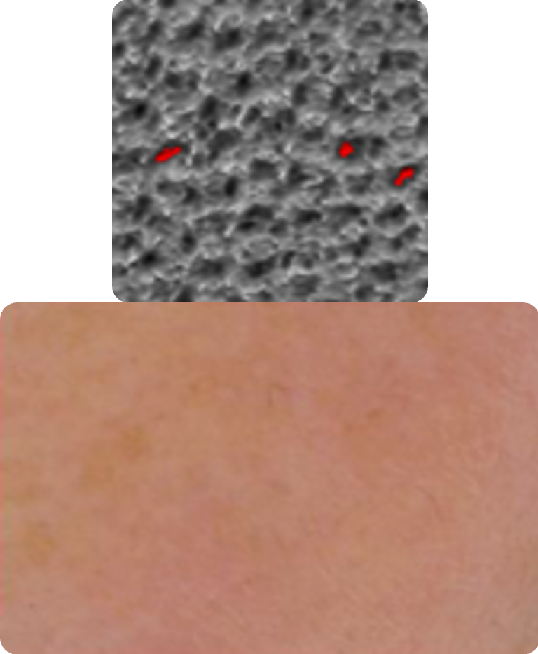 After treatment