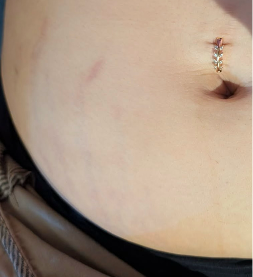After treatment