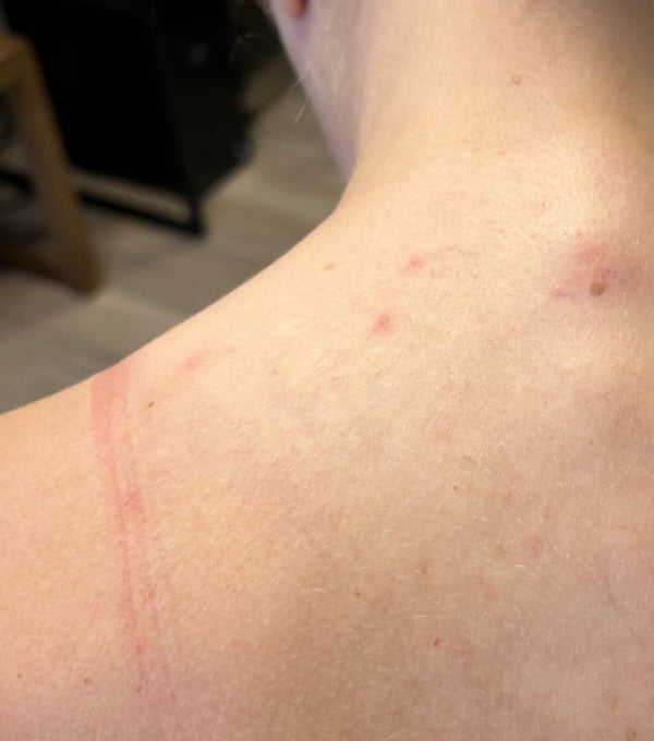 After treatment