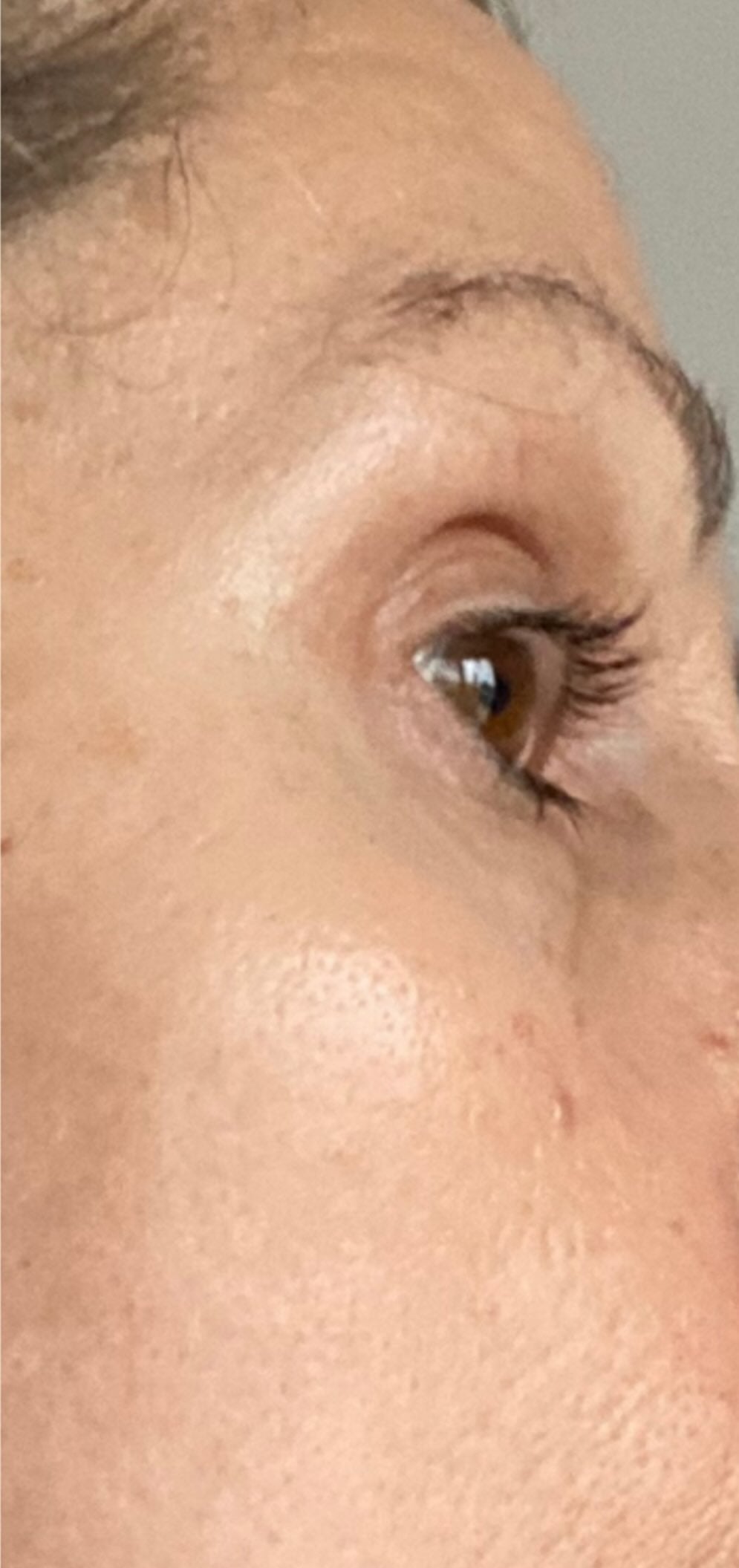 After treatment