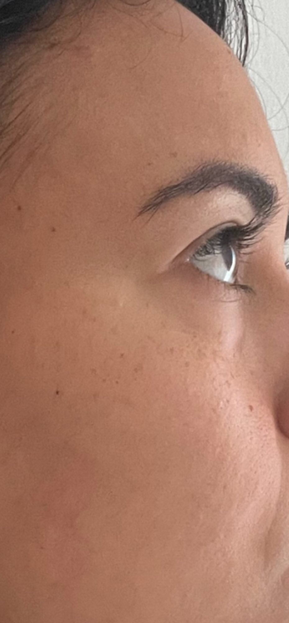 After treatment