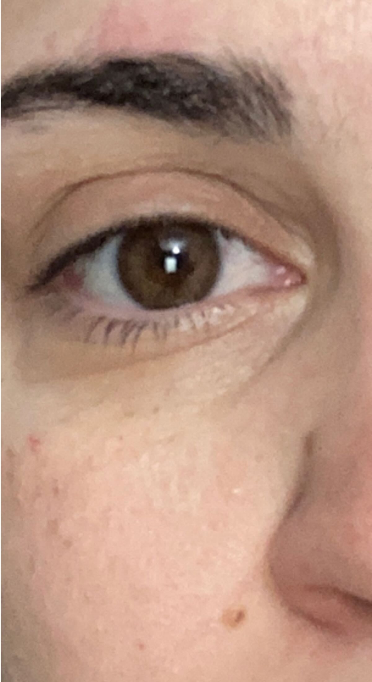 After treatment