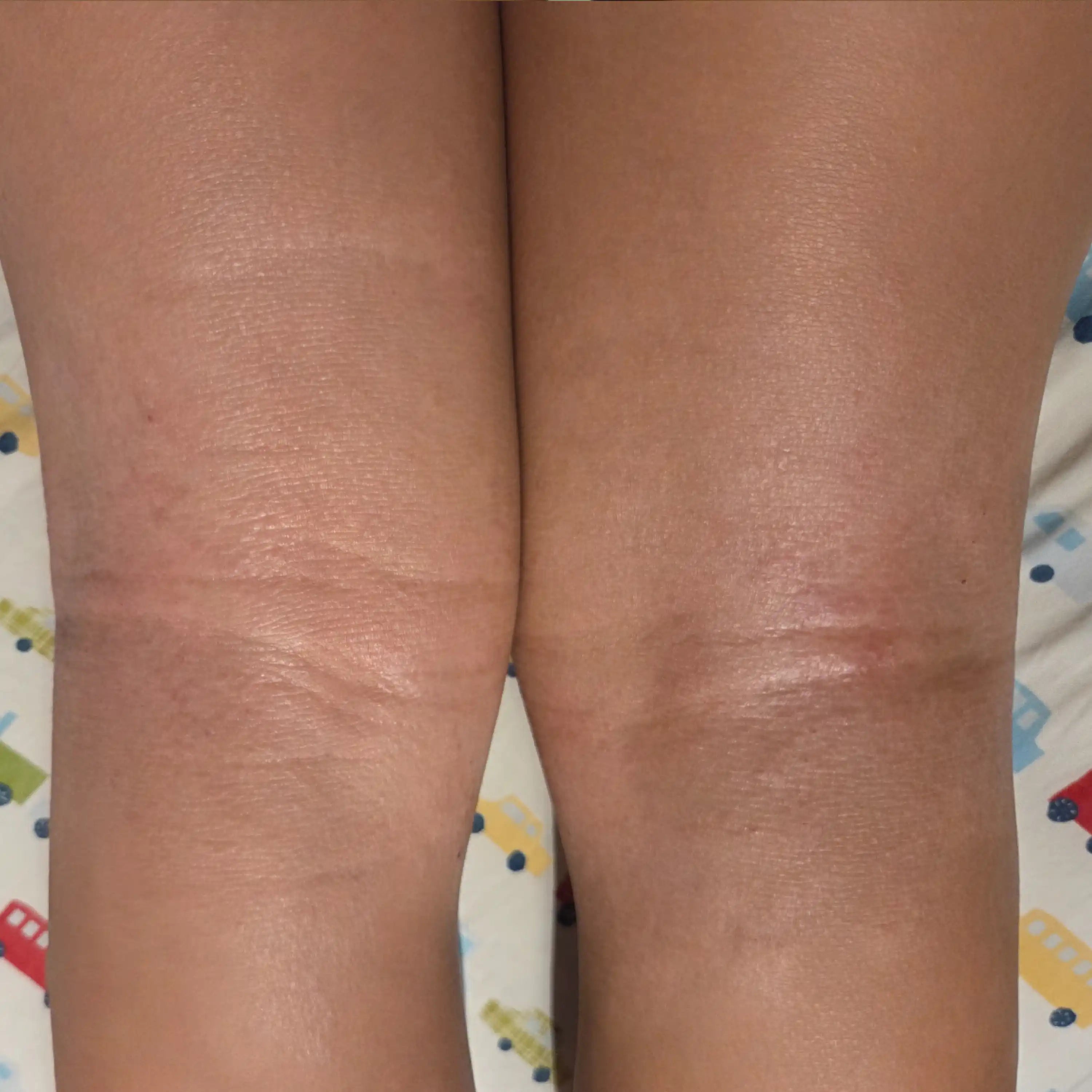 After treatment