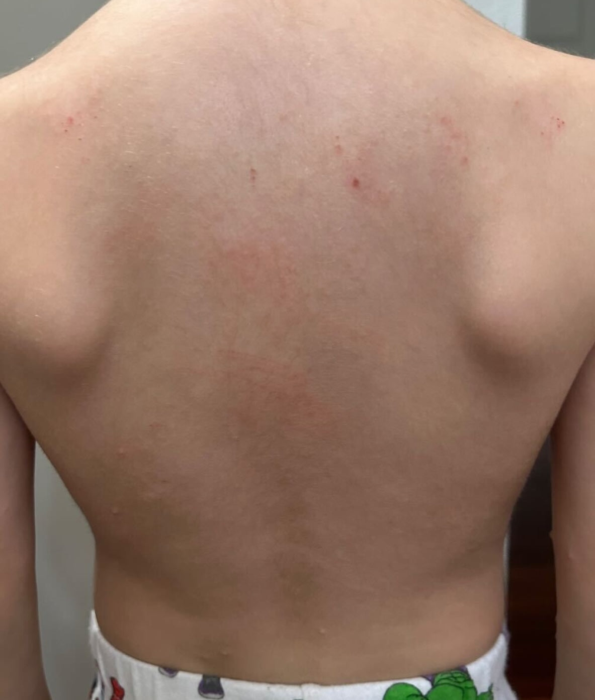 After treatment