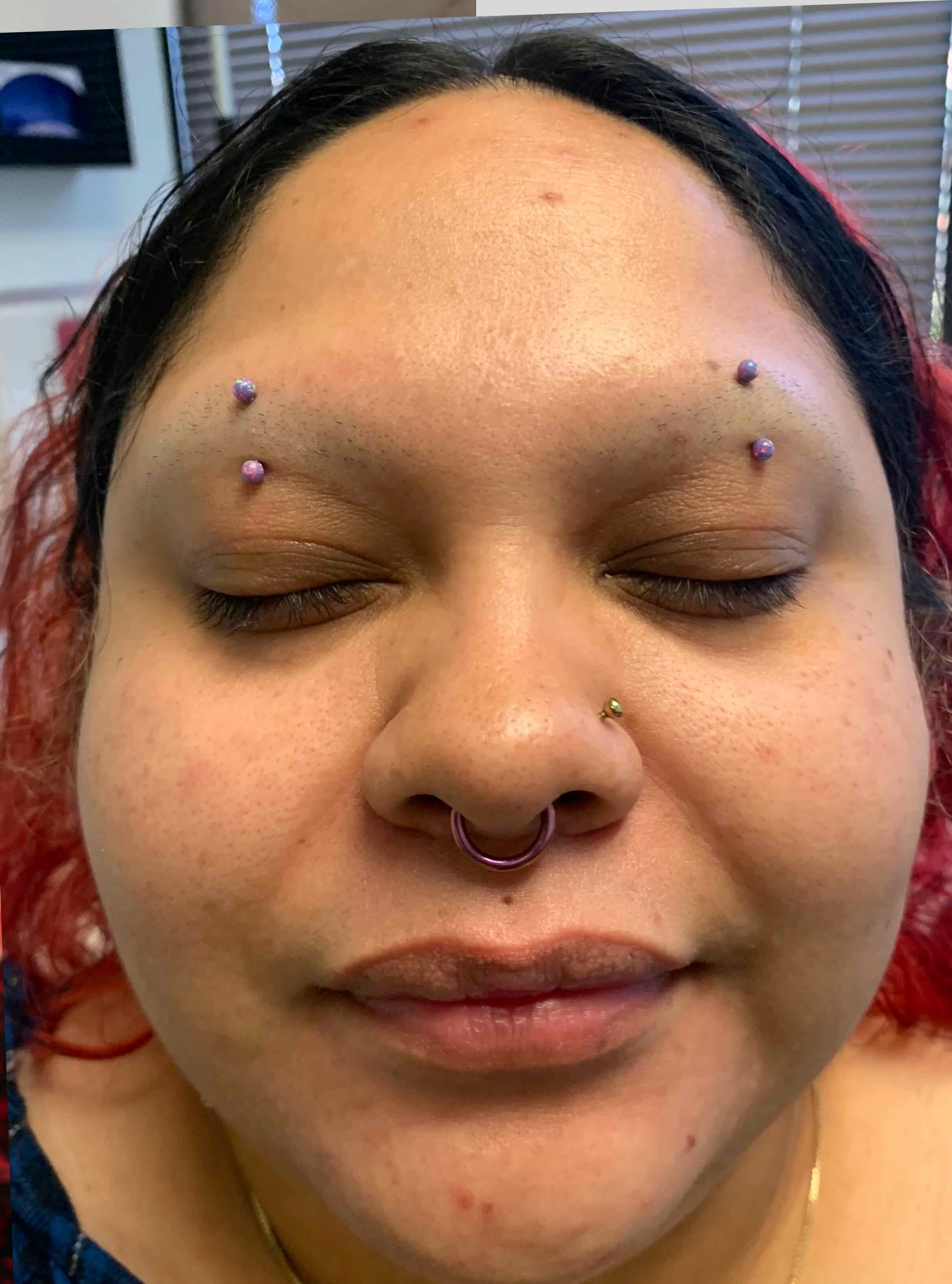 After treatment