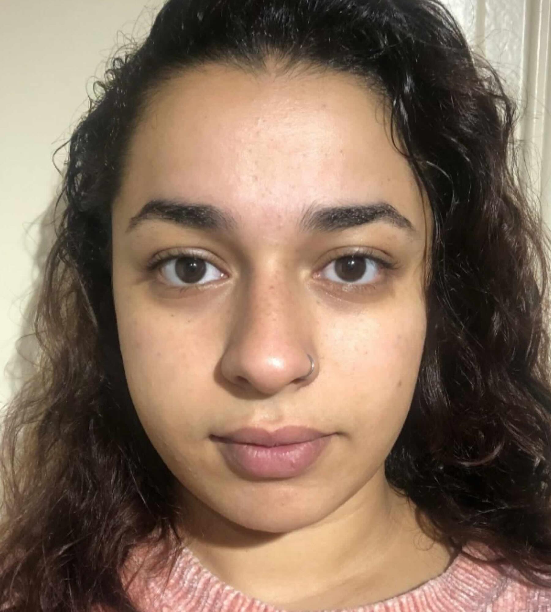 After treatment