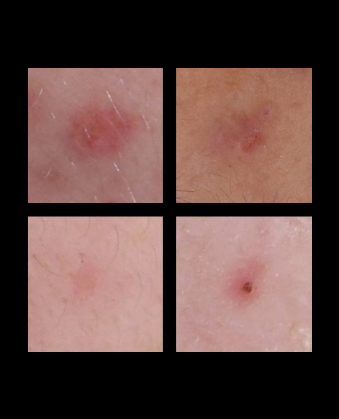 After treatment