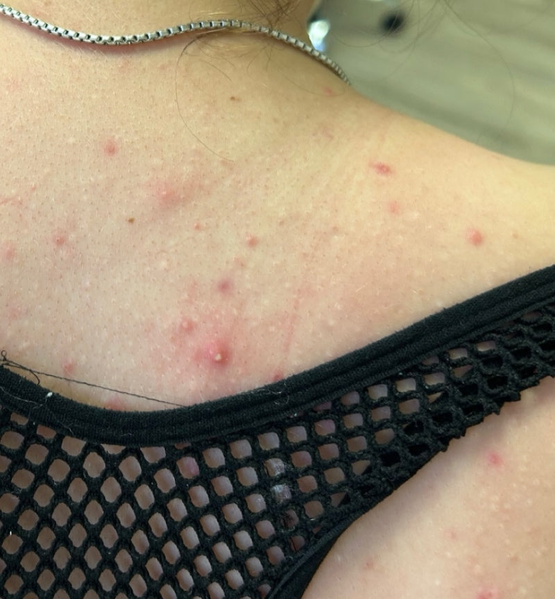 Before treatment