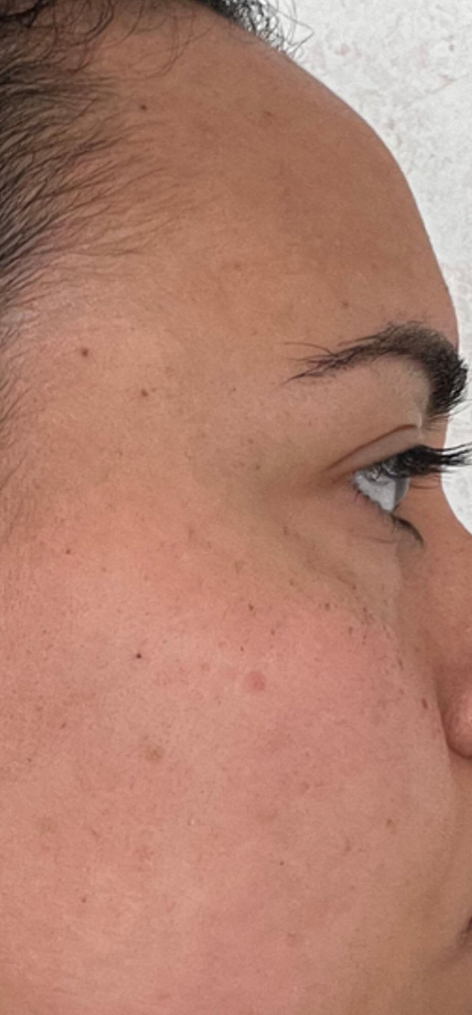 Before treatment