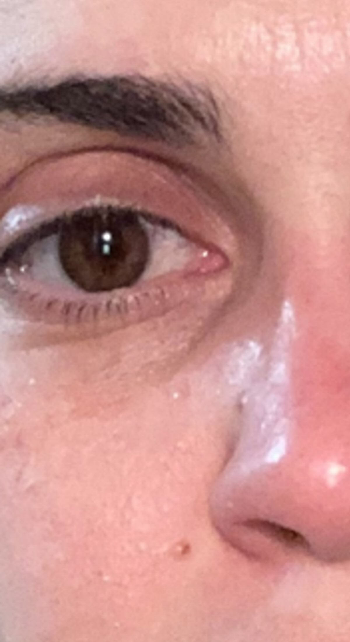Before treatment