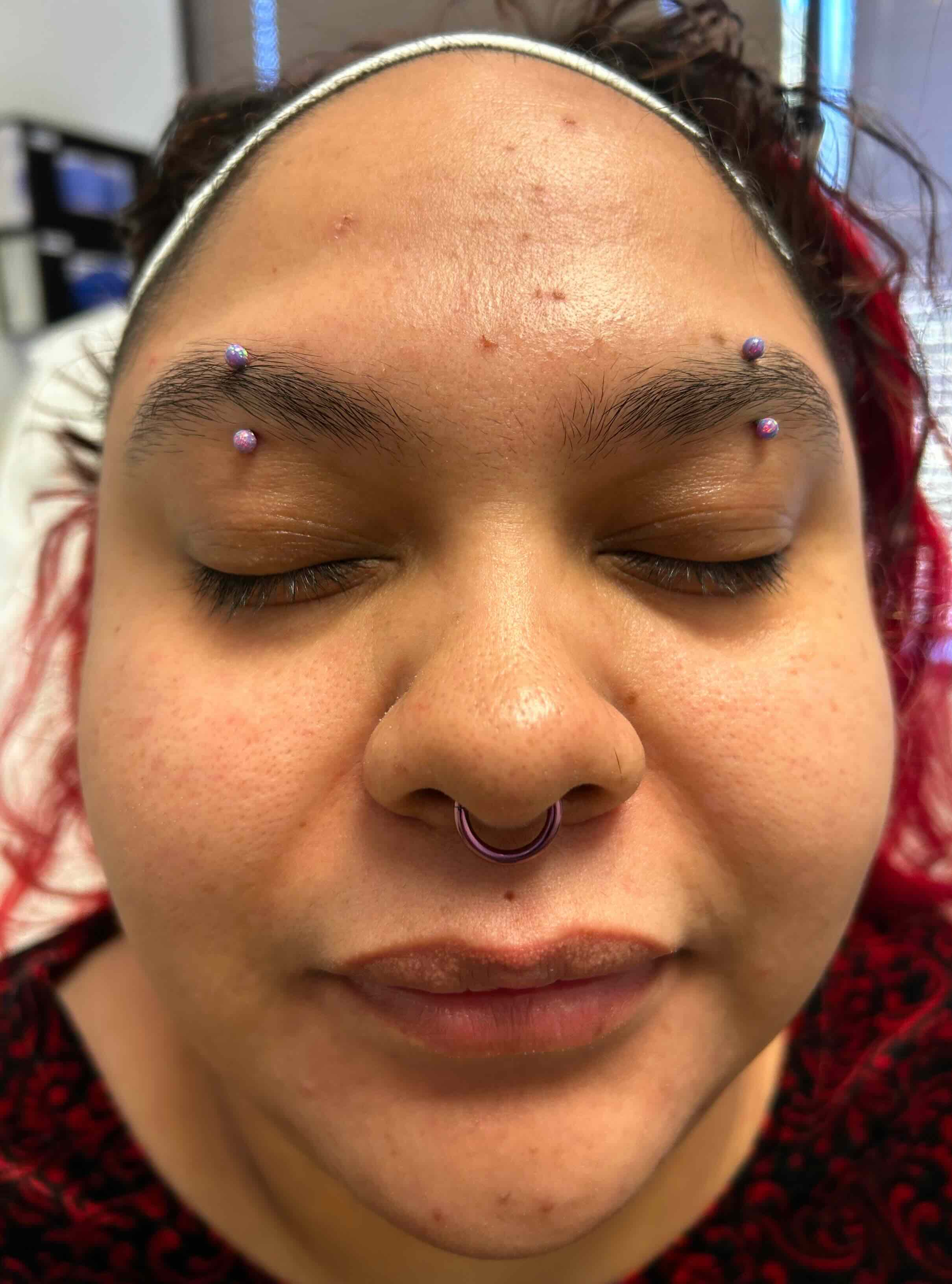 Before treatment