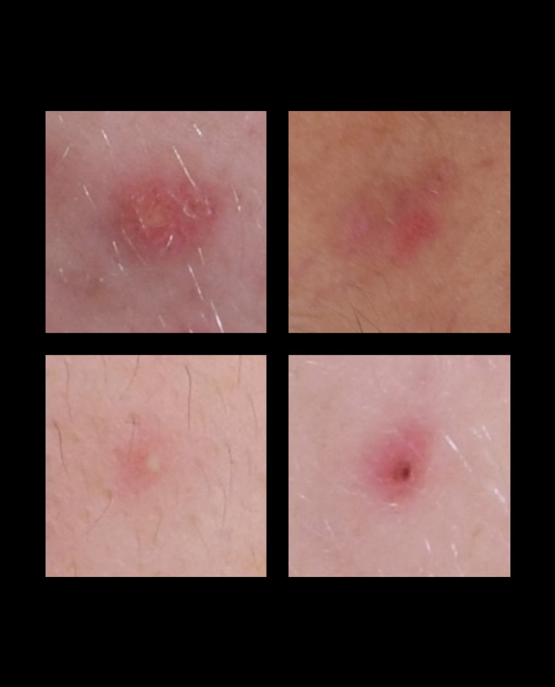 Before treatment