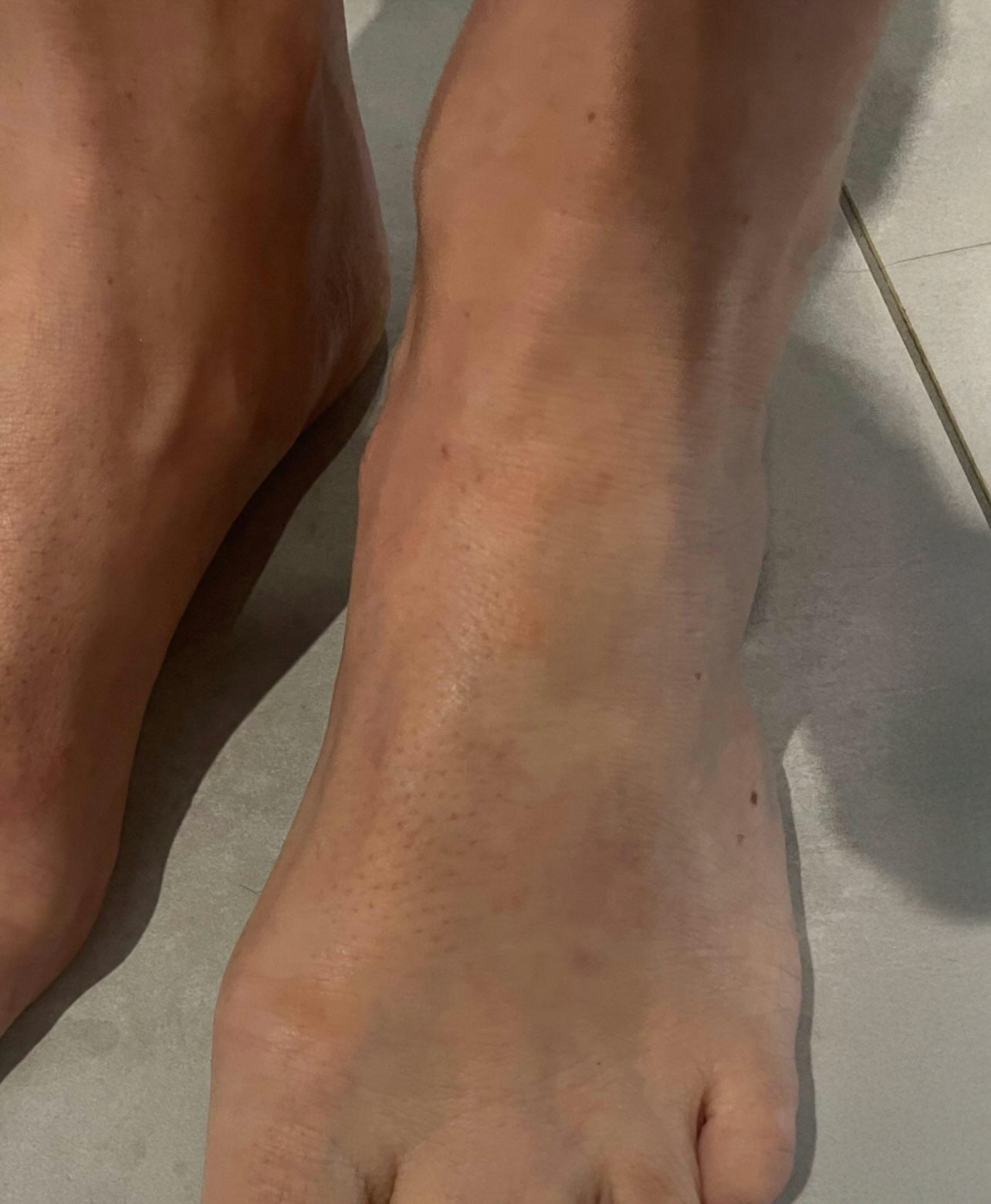 After treatment