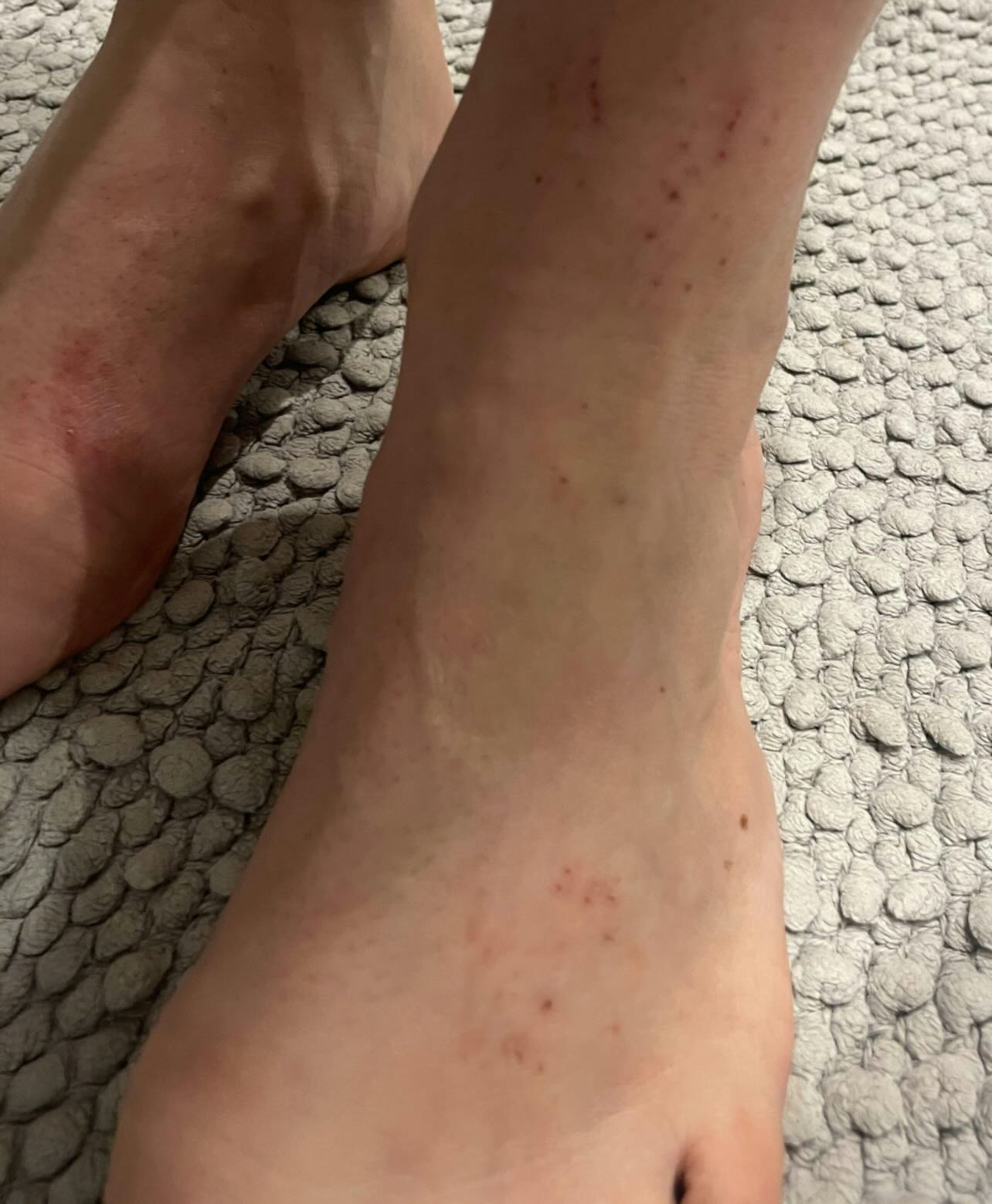 Before treatment