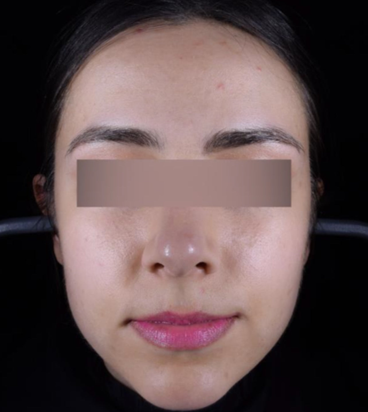 After treatment