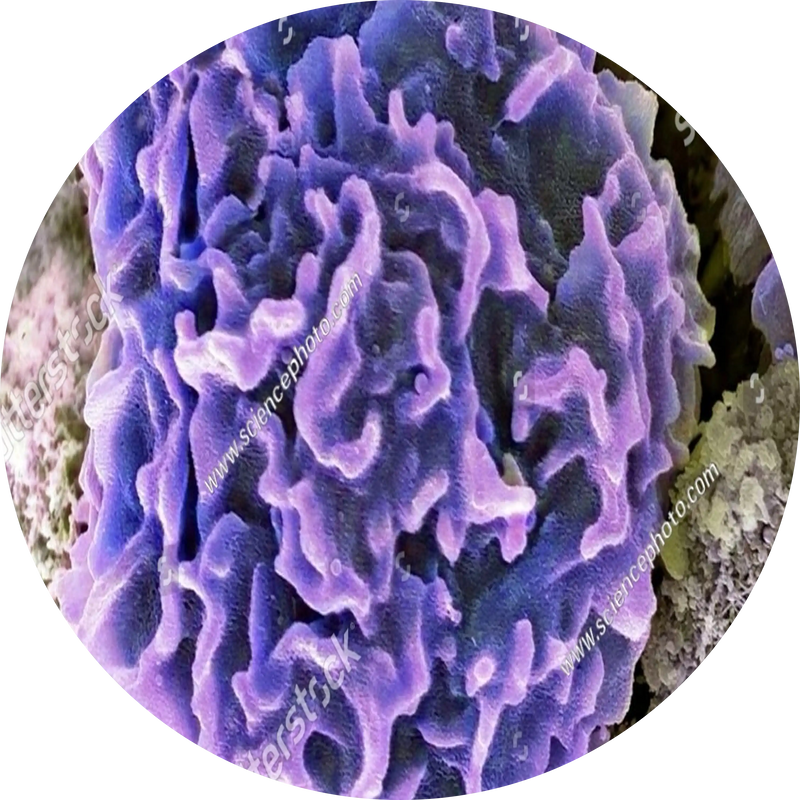 INFLAMMATION