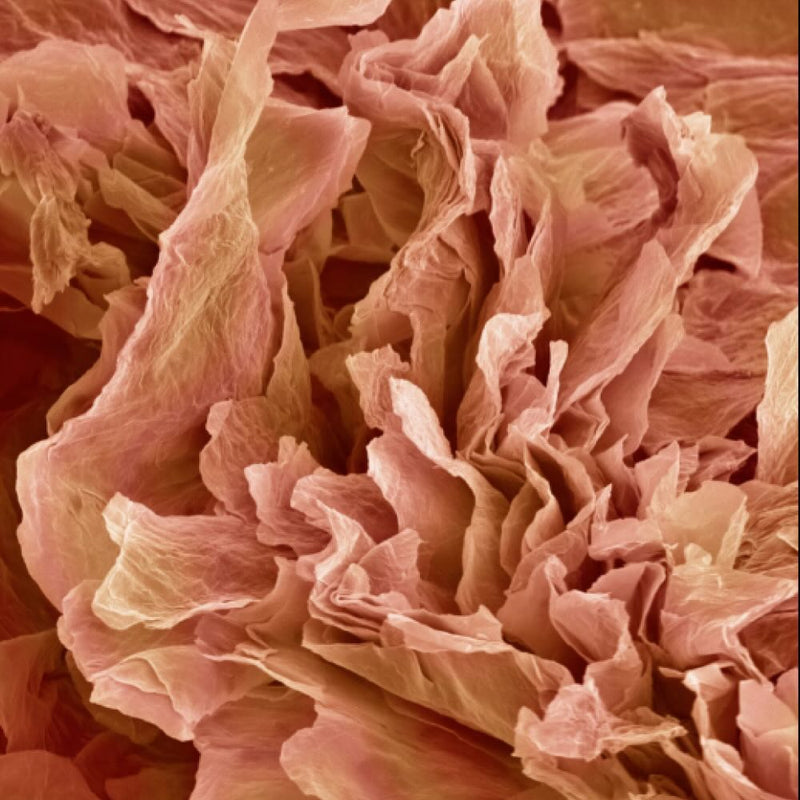 WEAK SKIN BARRIER = ITCH / FLARES