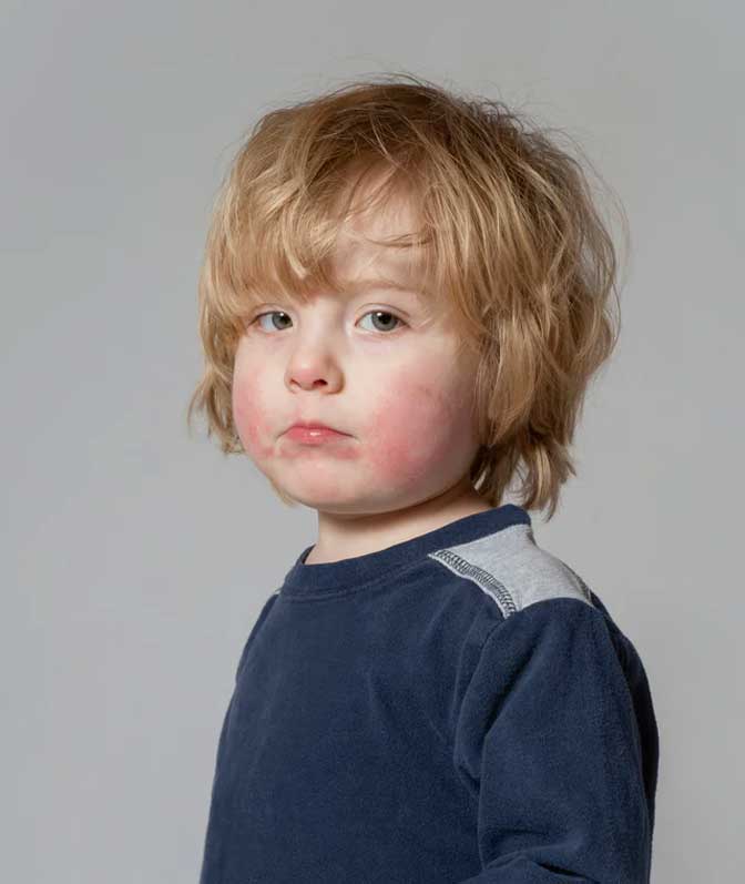 TODDLERS (1–3 YEARS)