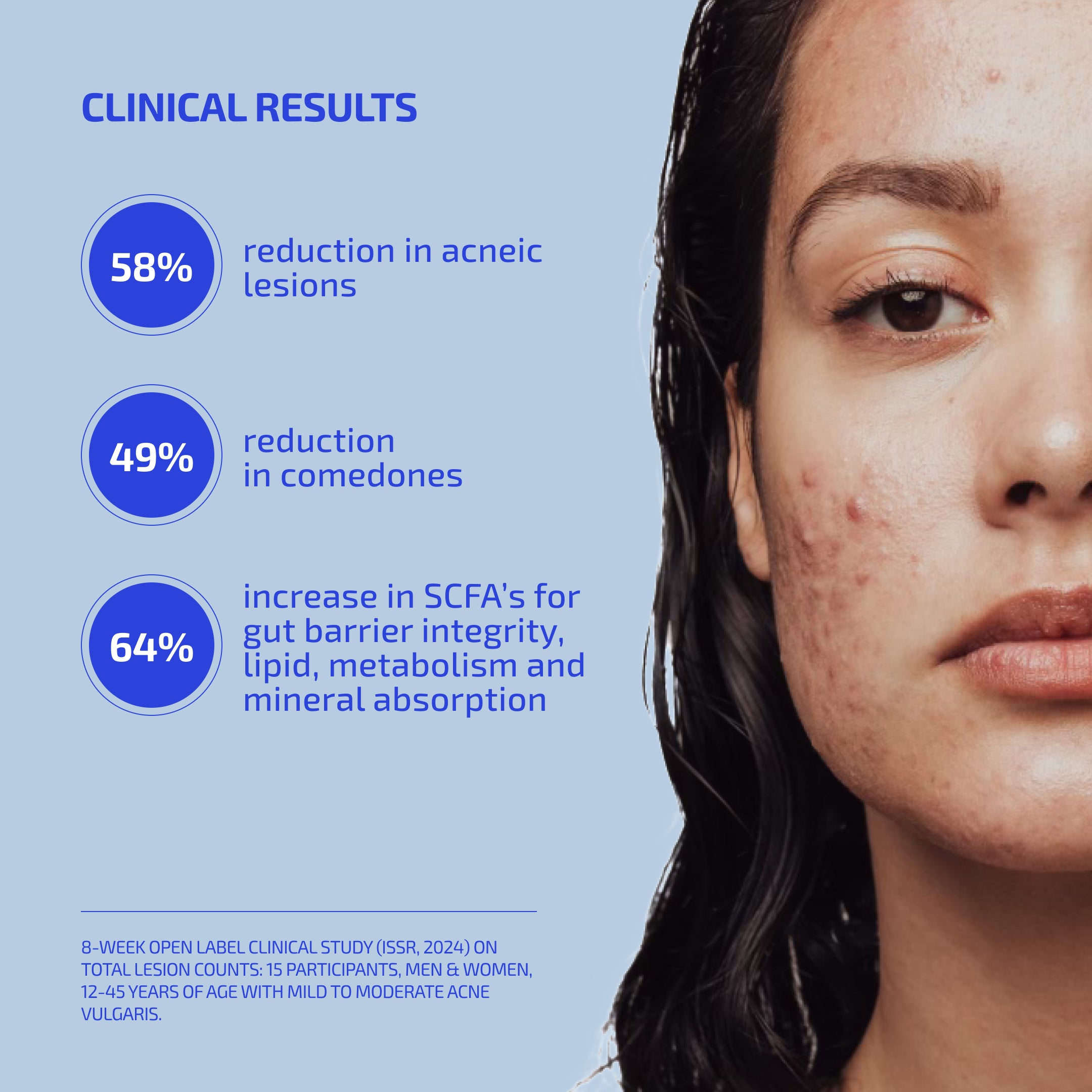 SHAANT ClearSkin Acne Relief Probiotic Supplement 2.0