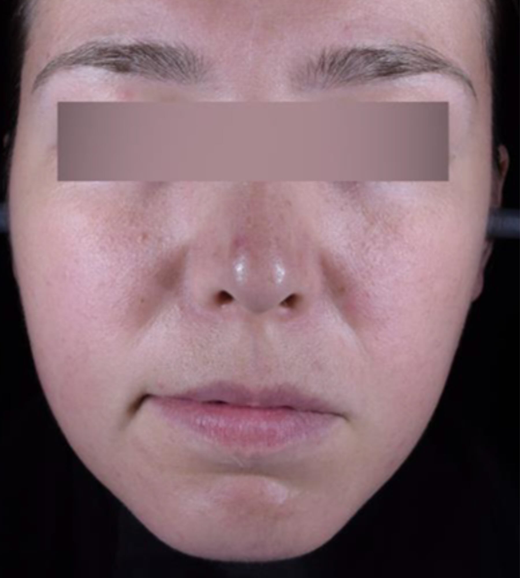 After treatment